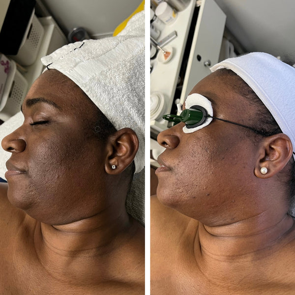 Brightening Pads Gleaux Aesthetics Skincare