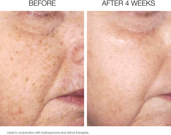 Brightening Pads