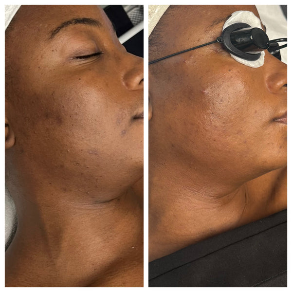 Bronze Gleaux Signature Subscription: $89 Gleaux Aesthetics Skincare