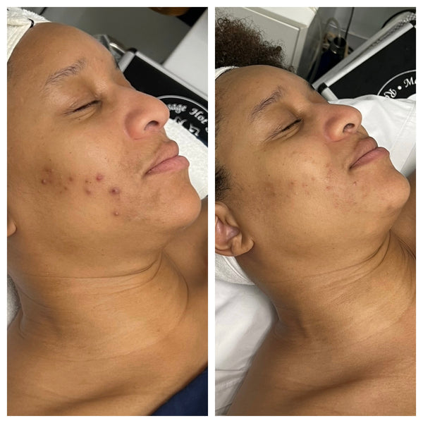 Radiant Gleaux Aesthetics Skincare