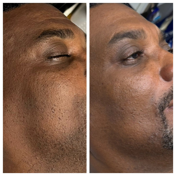Radiant Gleaux Aesthetics Skincare