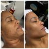Radiant Gleaux Aesthetics Skincare