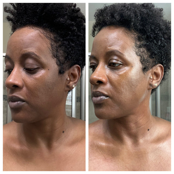 Radiant Gleaux Aesthetics Skincare