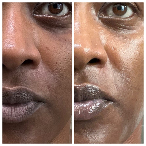 Nourish Gleaux Aesthetics Skincare