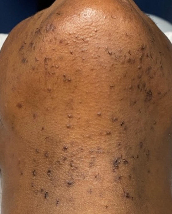 Brightening Pads Gleaux Aesthetics Skincare