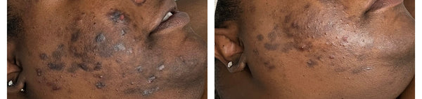 Radiant Gleaux Aesthetics Skincare