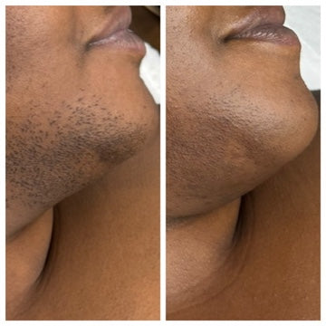 Brightening Pads Gleaux Aesthetics Skincare