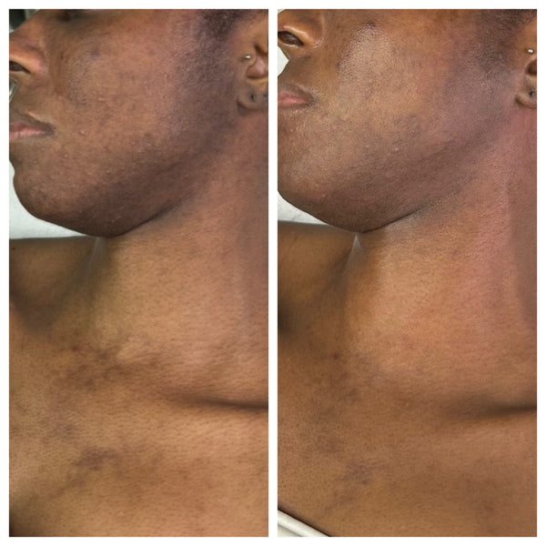 Radiant Gleaux Aesthetics Skincare