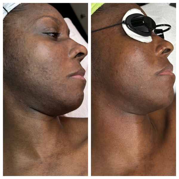 Radiant Gleaux Aesthetics Skincare