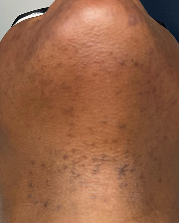 Brightening Pads Gleaux Aesthetics Skincare