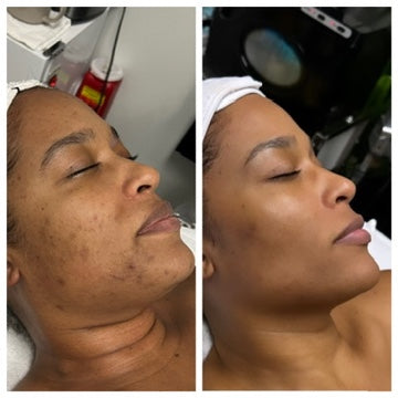 Radiant Gleaux Aesthetics Skincare