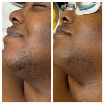 Brightening Pads Gleaux Aesthetics Skincare