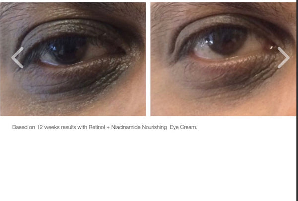 Renew Nourishing Eye Cream (Retinol)