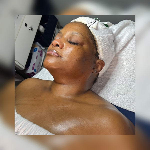 Gentle Enzyme Treatment Cleanser Gleaux Aesthetics Skincare