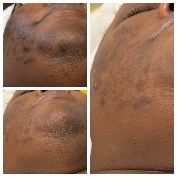 Platinum Gleaux Signature Subscription: $189 Gleaux Aesthetics Skincare