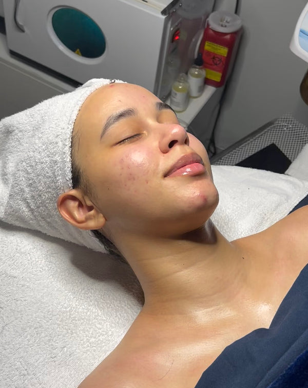 AHA/BHA Clarifying Pads Gleaux Aesthetics Skincare