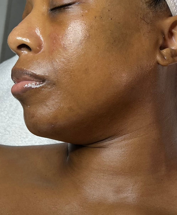 HA Boost Gleaux Aesthetics Skincare