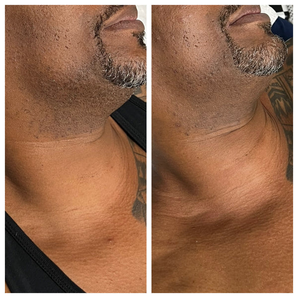 Brightening Pads Gleaux Aesthetics Skincare