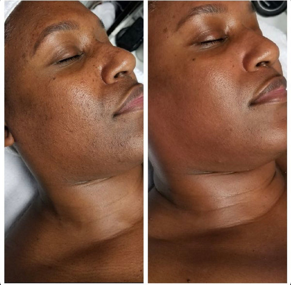 Gleaux Subscription Box SNEAK PEAK Gleaux Aesthetics Skincare